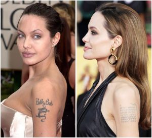Angelina Jolie's celebrity tattoo removal