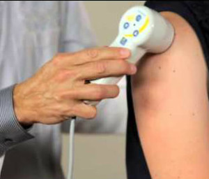 cold_laser_treatment_on_arm cold laser treatment on arm