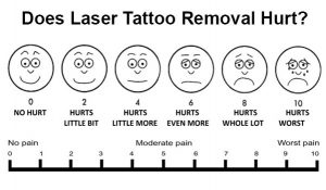 Does laser tattoo removal hurt?