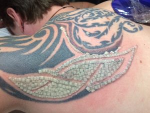 10 Side Effects Of Laser Tattoo Removal – What You Should Know
