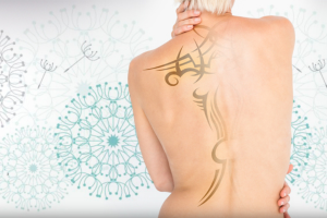 Can you completely remove a tattoo